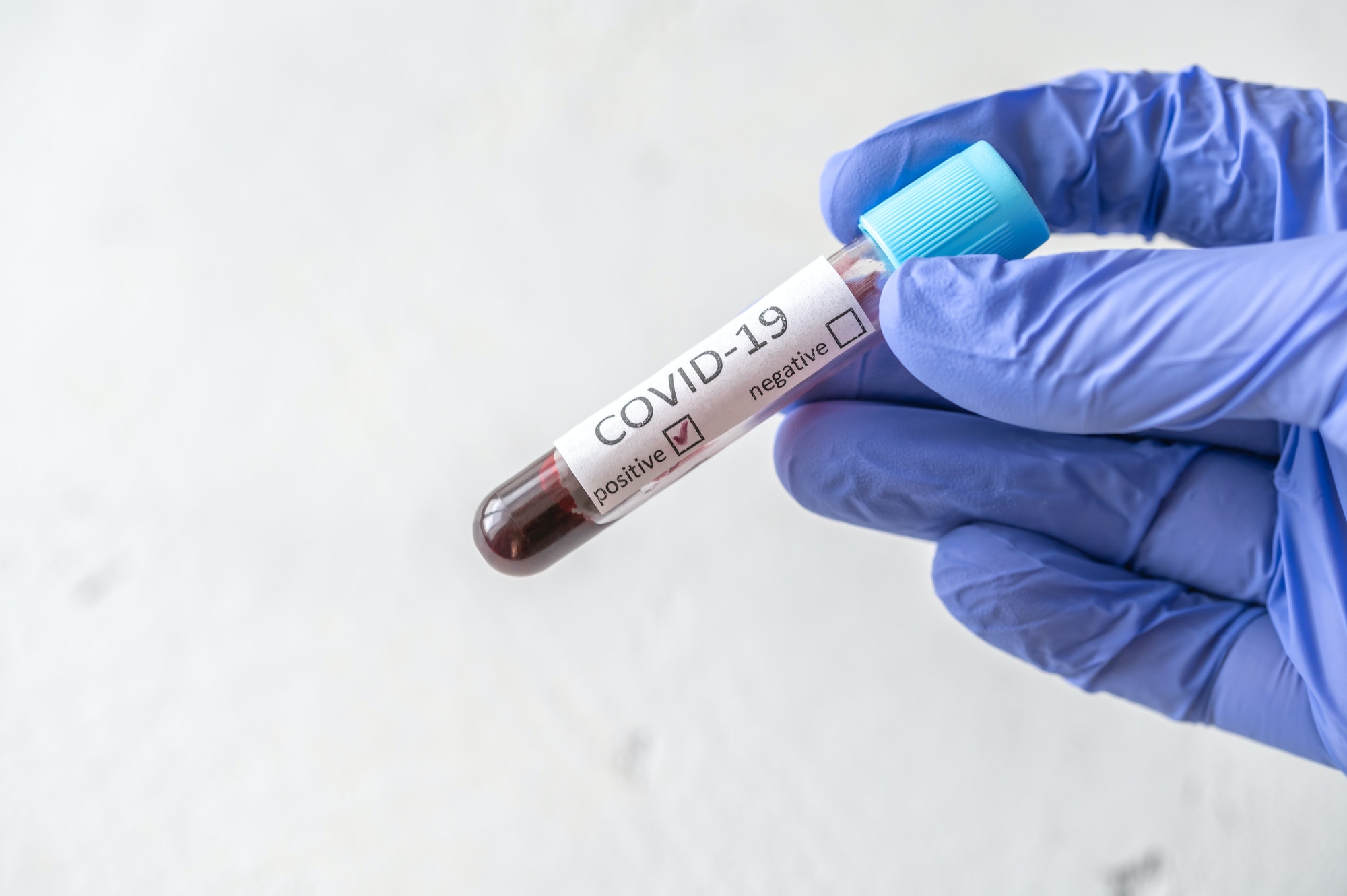 Coronavirus testing